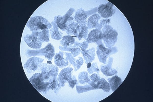 FLX-Blog-When-Do-Portable-X-ray-Machine-Rentals-Make-Sense